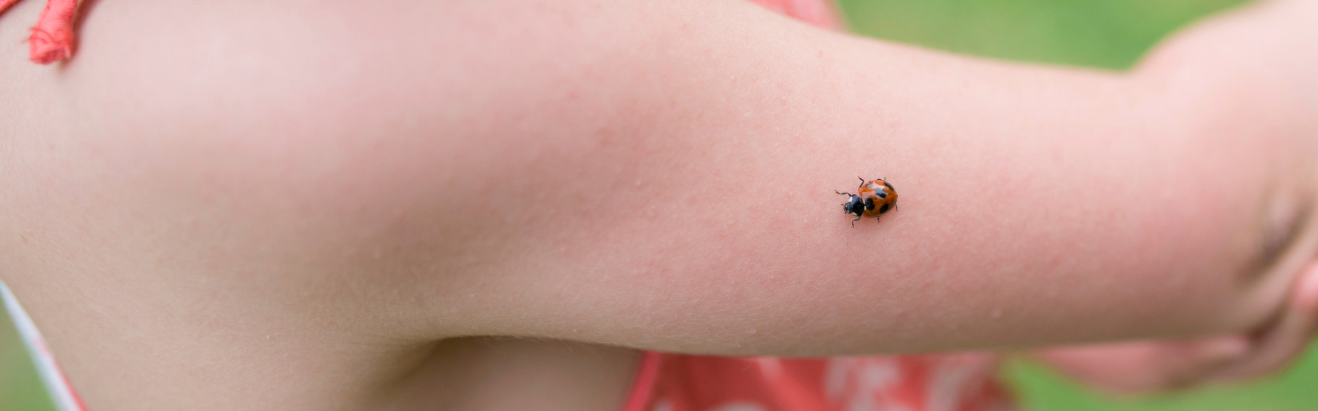 ¿Qué hacer en caso de picaduras de insectos?