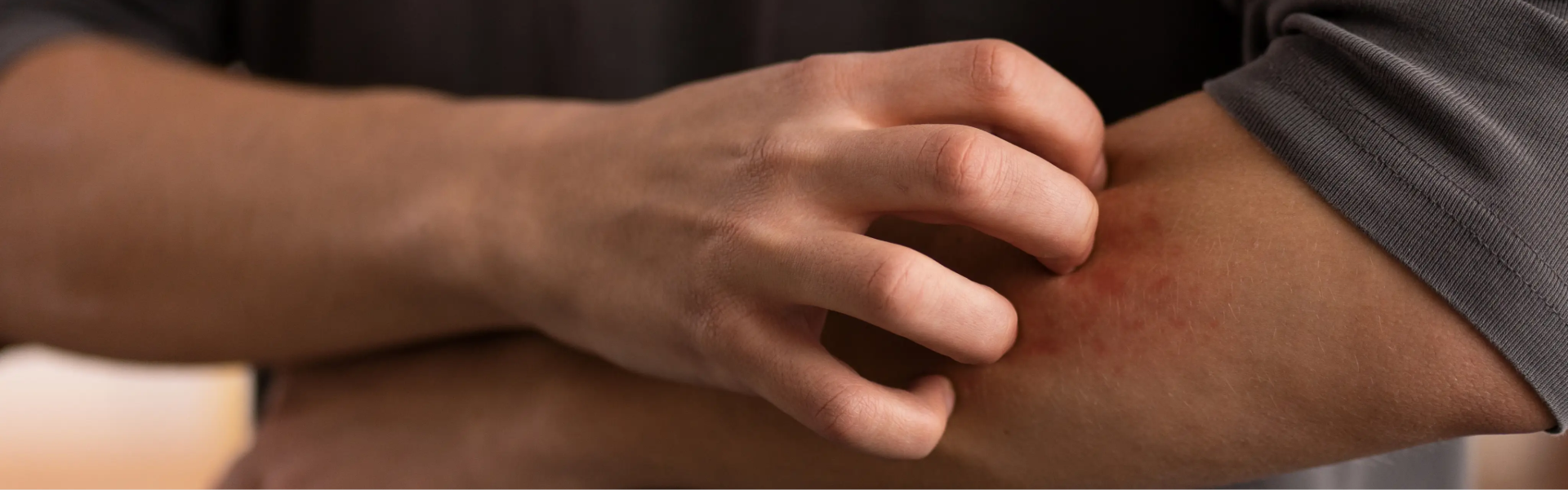 Reconoce los síntomas del sarampión, como fiebre alta y erupciones, y conoce las medidas clave para prevenir el contagio, incluyendo la vacunación.